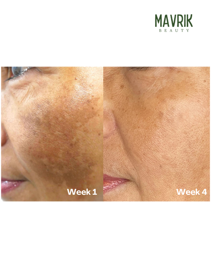 Turmeric & Kojic Acid Soap