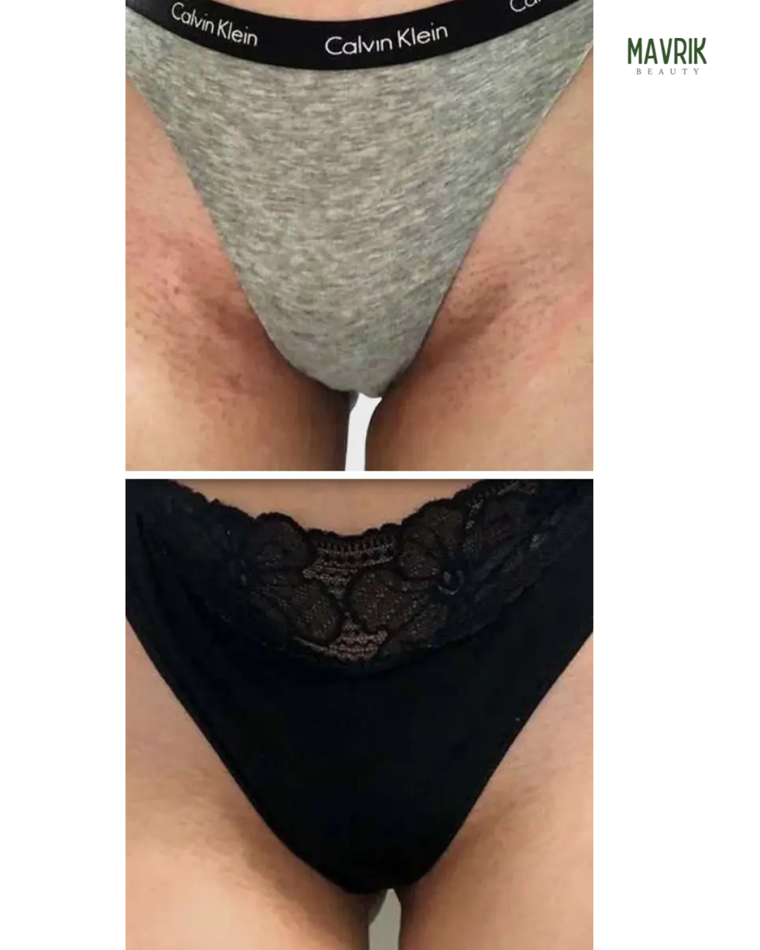 Turmeric & Kojic Acid Soap