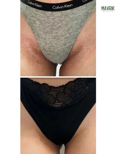 Turmeric & Kojic Acid Soap