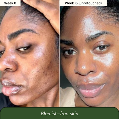 Turmeric & Kojic Acid Soap