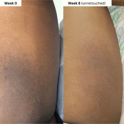 Turmeric & Kojic Acid Soap