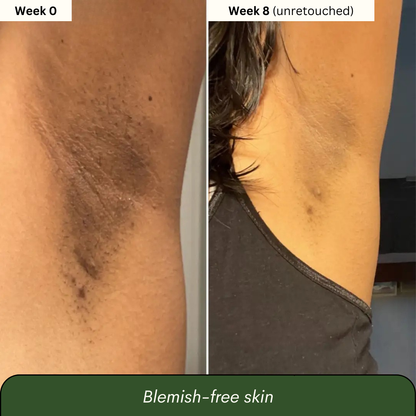 Turmeric & Kojic Acid Soap