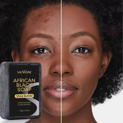 African Black Soap (2 Pack)
