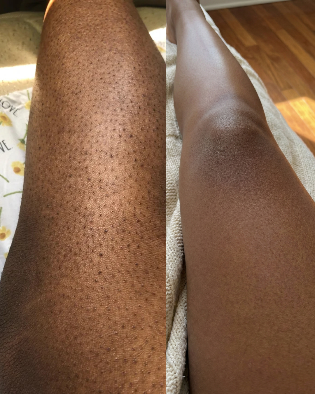 Turmeric Brightening Soap (with Vitamin C, Shea Butter, Kojic Acid)